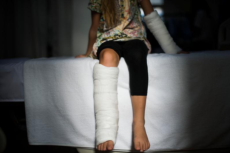 Young Caucasian girl with broken leg in plaster cast. 