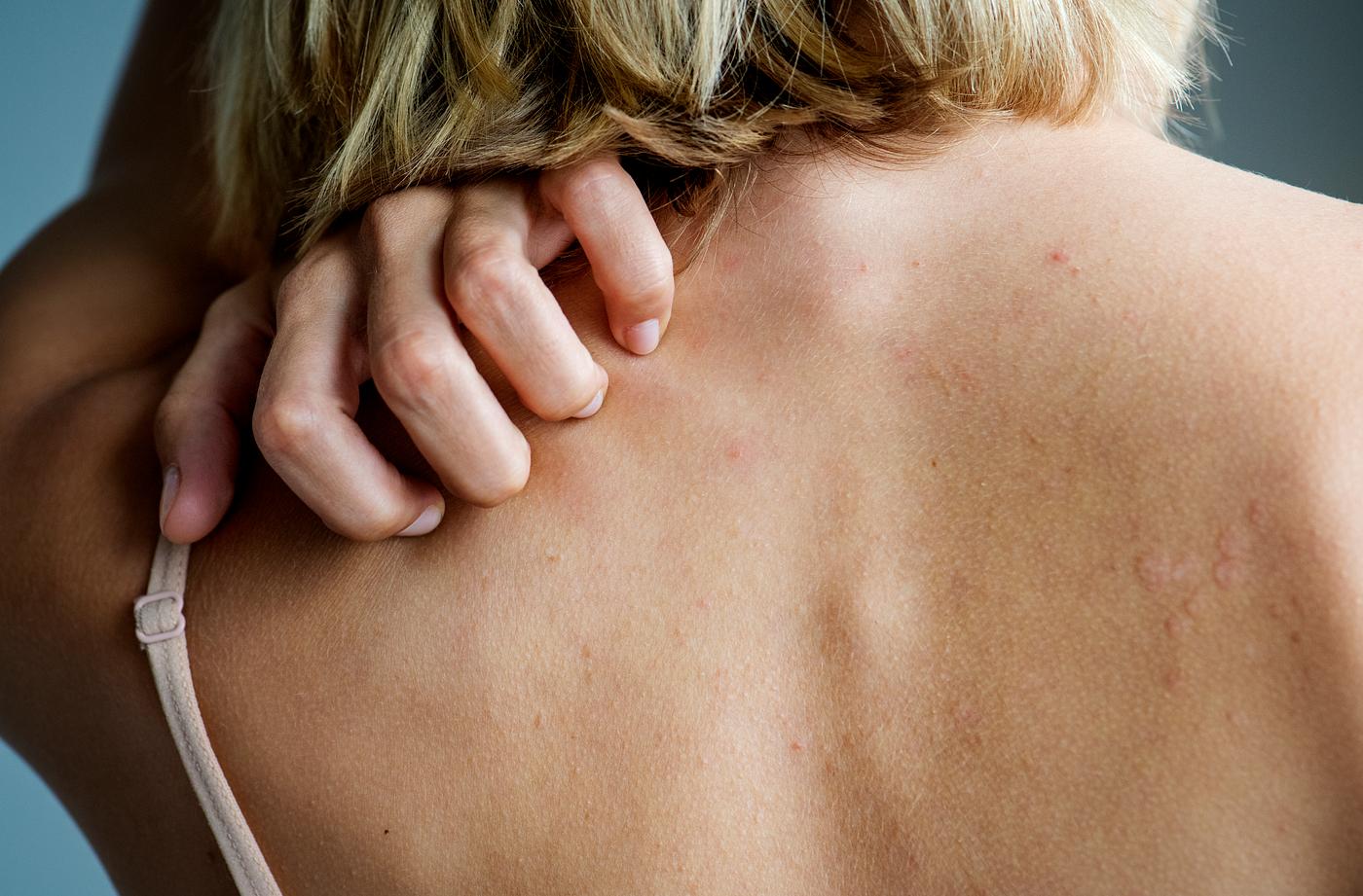 learning-the-early-symptoms-of-blood-cancer-2