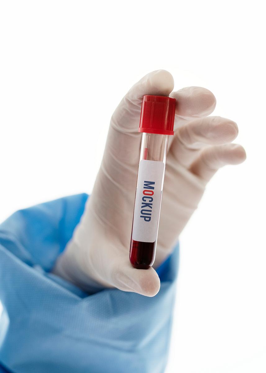 Download Test Tube Images Free Vectors Pngs Mockups Backgrounds Rawpixel