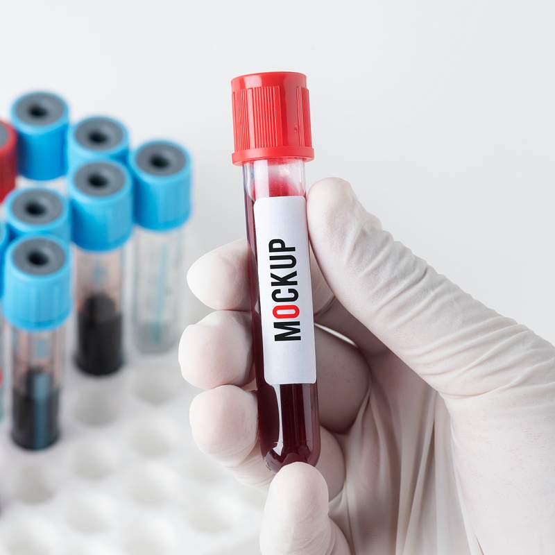 Download Blood Sample Images | Free Vectors, PNGs, Mockups & Backgrounds - rawpixel