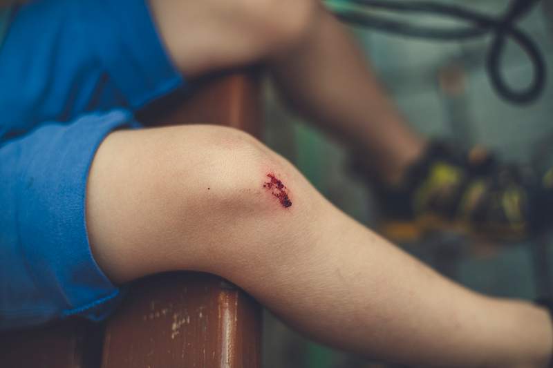 Boy with a bleeding wound on his knee
We are… | Free public domain photo Boy with a bleeding wound on his knee
We are proud to support Hope for Children on their mission to ensure children in the…