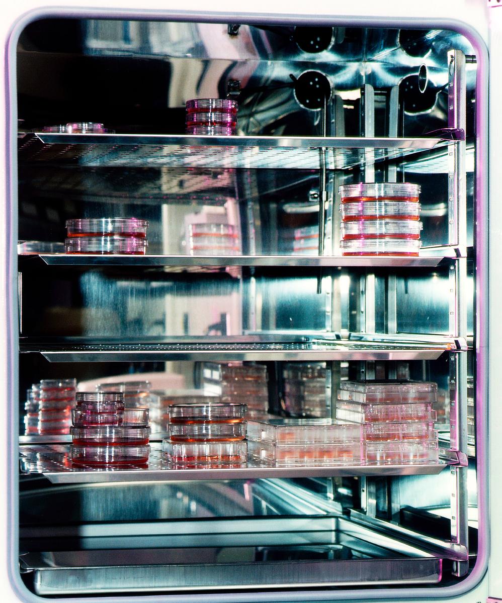 Breast tissue specimens in traditional sample… | Free public domain photo Breast tissue specimens in traditional sample dishes. Original from NASA . Digitally enhanced by rawpixel.