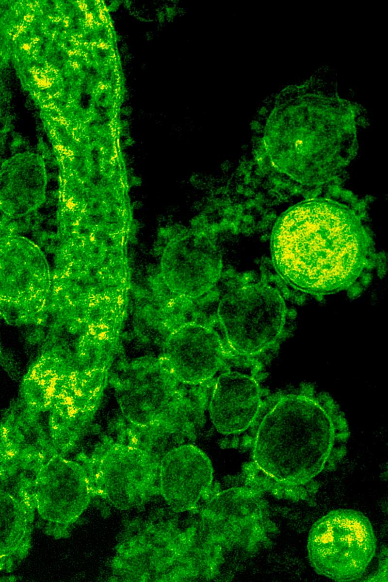 Green coronavirus under a microscope. A healthcare provider donning a pair of green latex gloves in order to protect herself…