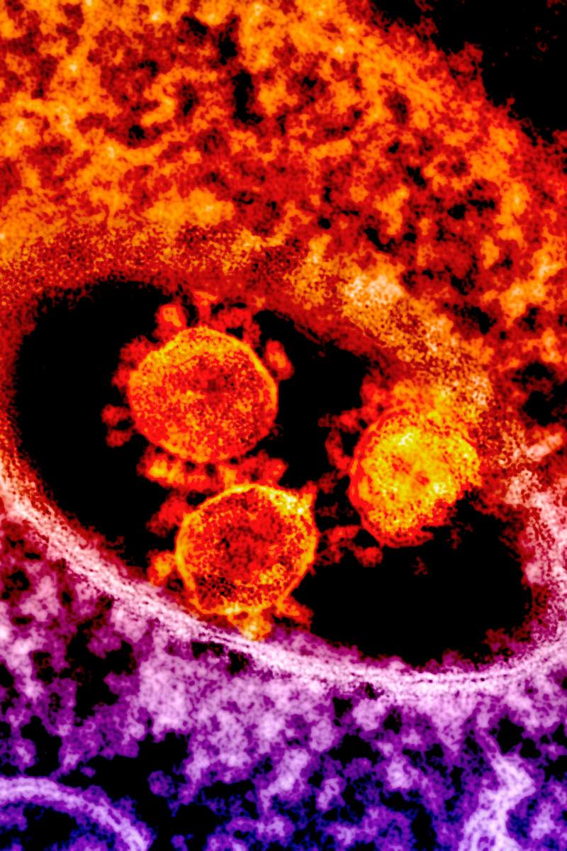 Living organisms under a microscopic view. Original image sourced from US Government department: Public Health Image Library…