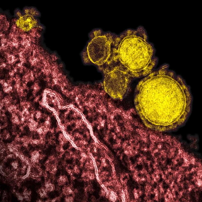 Magnified respiratory syndrome coronavirus. Original image sourced from US Government department: Public Health Image…