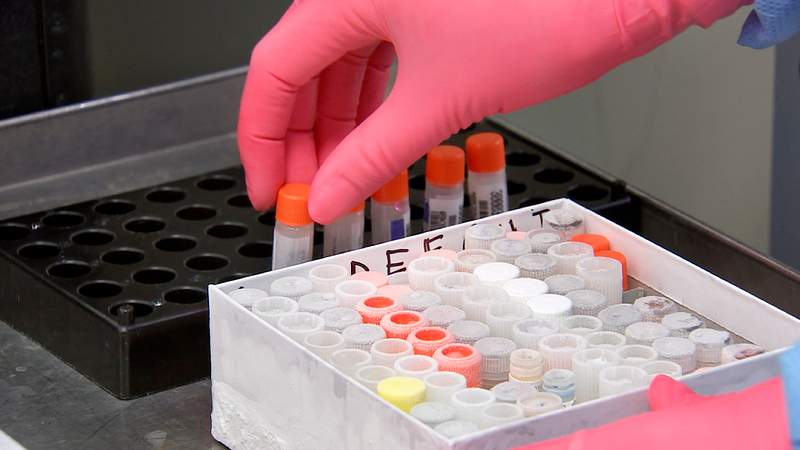 Sample of test tubes. A healthcare provider donning a pair of green latex gloves in order to protect herself during her…