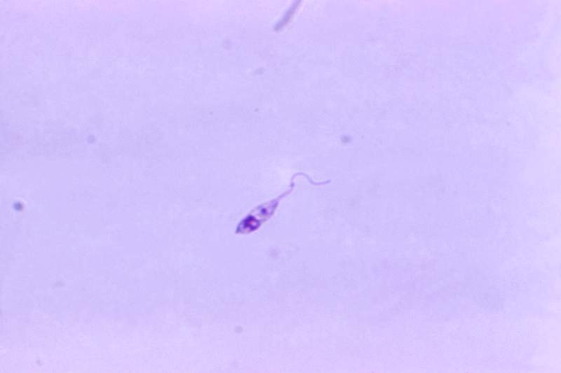 Photomicrograph of a parasite. Original image sourced from US Government department: Public Health Image Library, Centers for…
