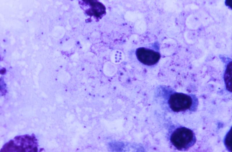 Photomicrograph of Giemsa stained lung tissue. Original image sourced from US Government department: Public Health Image…