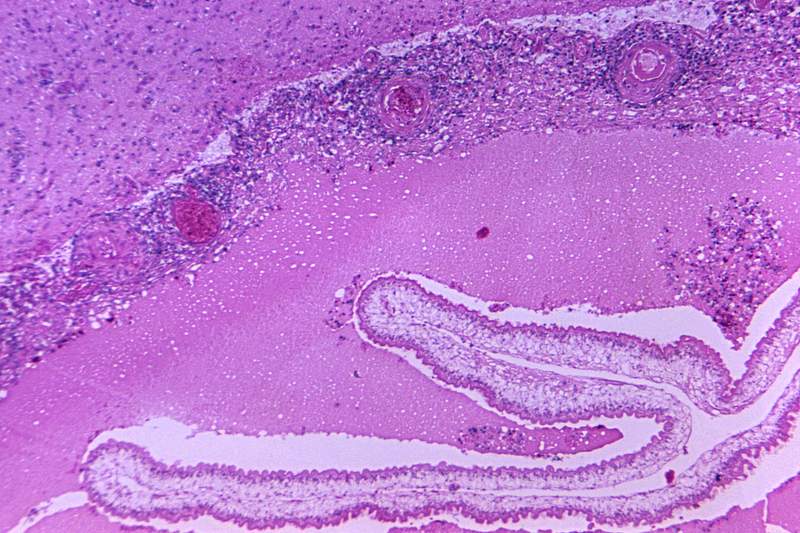Photomicrograph of a brain tissue specimen. Original image sourced from US Government department: Public Health Image…