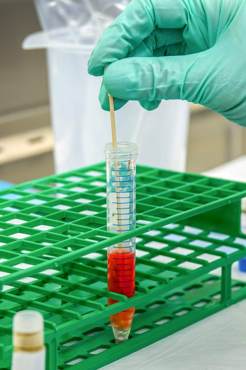 A scientist adding a stool sample to the cell culture medium, along with glass beads. Original image sourced from US…