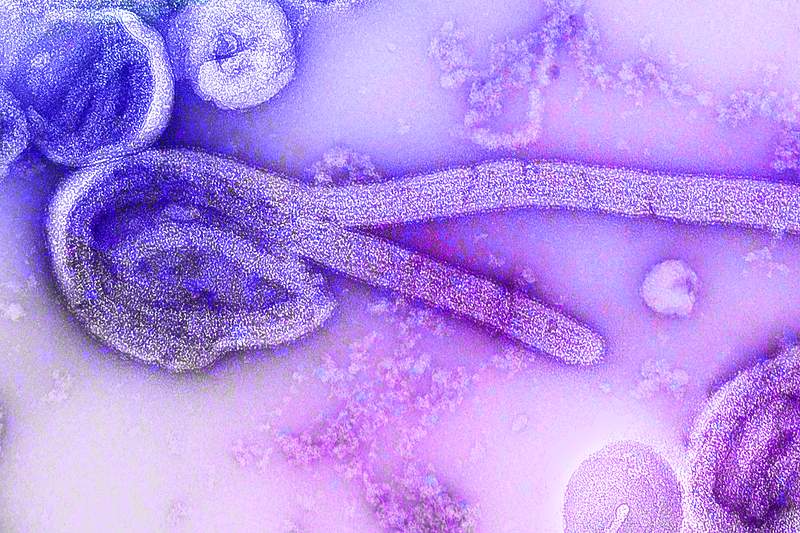 Electron microscopic image of Ebola virus. A healthcare provider donning a pair of green latex gloves in order to protect…
