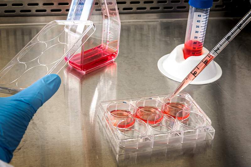 Test Tubes from experimenting on coronavirus. Original image sourced from US Government department: Public Health Image…