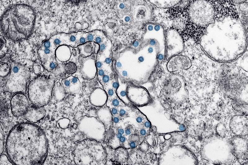 White coronavirus under a Microscope. Original image sourced from US Government department: Public Health Image Library…