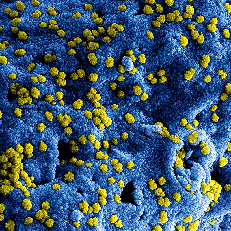MERS Coronavirus Particles–Colorized scanning electron micrograph of Middle East Respiratory Syndrome virus particles…