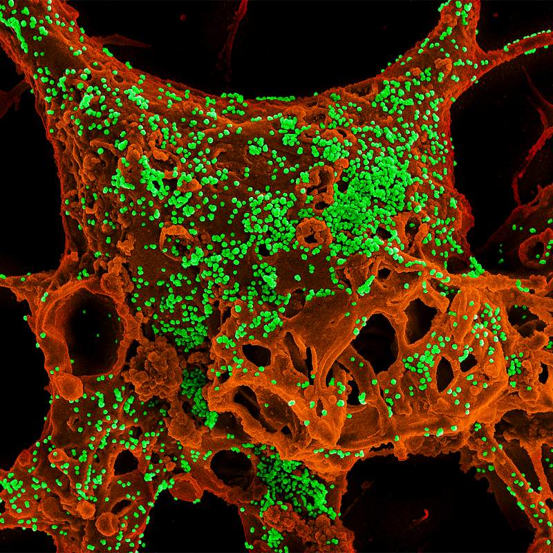 MERS Coronavirus Particles–Color-enhanced scanning electron micrograph of Vero E6 cells infected with Middle East…