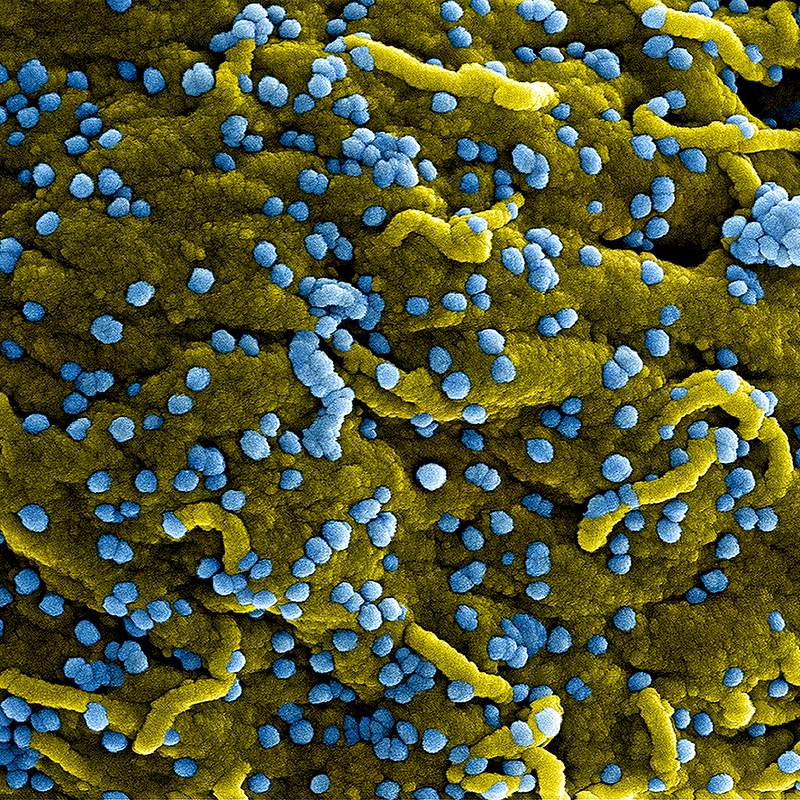 MERS Coronavirus Particles–Colorized scanning electron micrograph of Marburg virus particles (blue) both budding and…