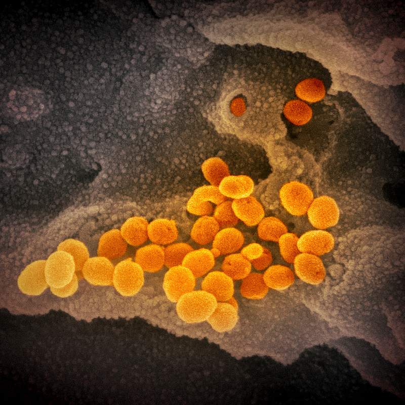 Novel Coronavirus SARS-CoV-2This scanning electron microscope image shows SARS-CoV-2 (orange)—also known as 2019-nCoV…
