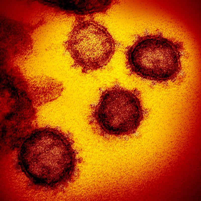 Novel Coronavirus SARS-CoV-2–This transmission electron microscope image shows SARS-CoV-2—also known as 2019…