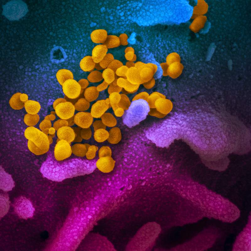 Novel Coronavirus SARS-CoV-2–This scanning electron microscope image shows SARS-CoV-2 (yellow)—also known as 2019…