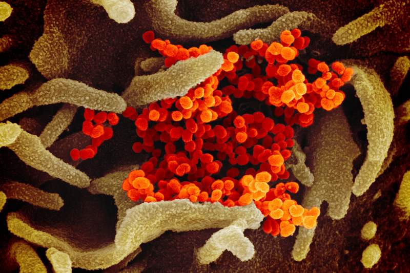 Novel Coronavirus SARS-CoV-2–This scanning electron microscope image shows SARS-CoV-2—also known as 2019-nCoV…