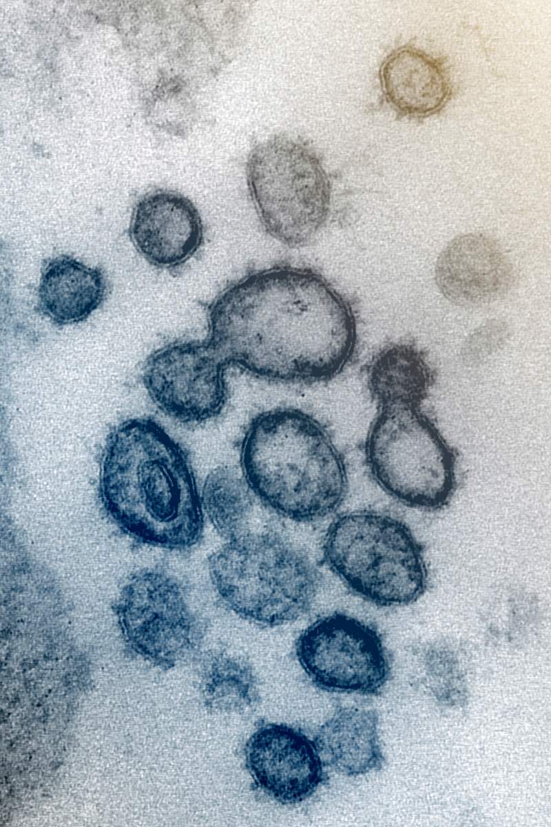 Novel Coronavirus SARS-CoV-2–This scanning electron microscope image shows SARS-CoV-2—also known as 2019-nCoV…