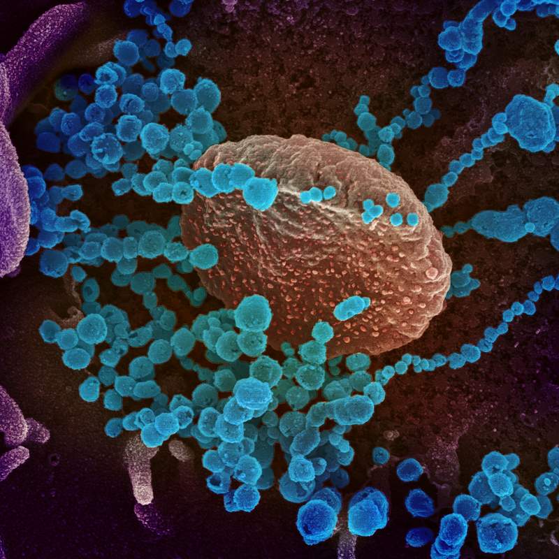 Novel Coronavirus SARS-CoV-2
This scanning electron microscope image shows SARS-CoV-2 (round blue objects) emerging from the…