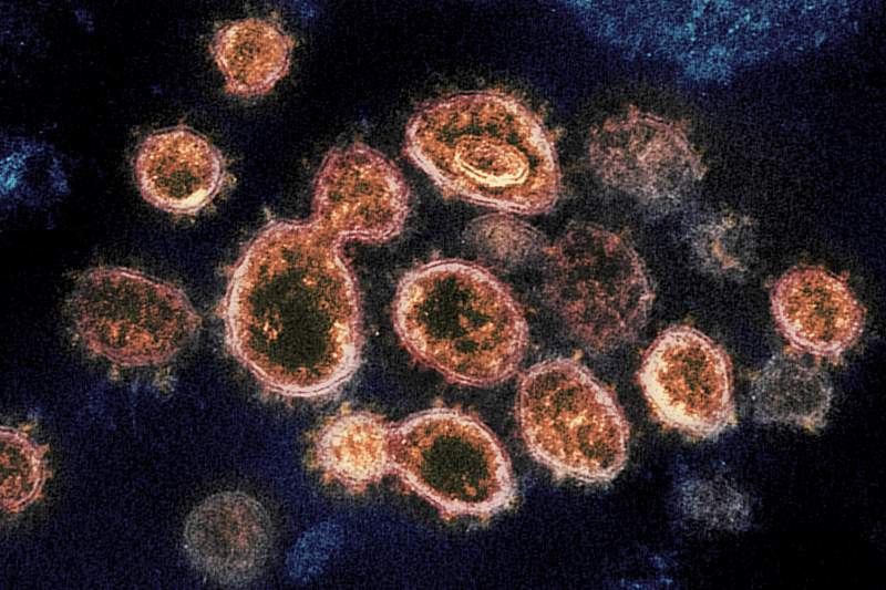 Novel Coronavirus SARS-CoV-2–This transmission electron microscope image shows SARS-CoV-2, the virus that causes COVID…