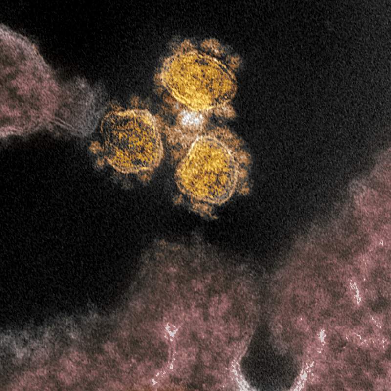Novel Coronavirus SARS-CoV-2–This transmission electron microscope image shows SARS-CoV-2, the virus that causes COVID…