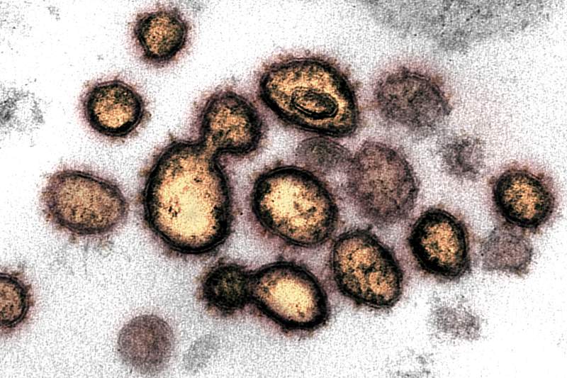 Novel Coronavirus SARS-CoV-2–This transmission electron microscope image shows SARS-CoV-2, the virus that causes COVID…