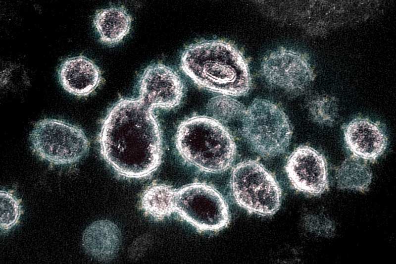 Novel Coronavirus SARS-CoV-2–This transmission electron microscope image shows SARS-CoV-2, the virus that causes COVID…