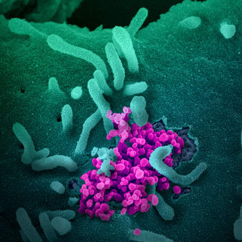 Novel Coronavirus SARS-CoV-2–This scanning electron microscope image shows SARS-CoV-2 (round magenta objects) emerging…