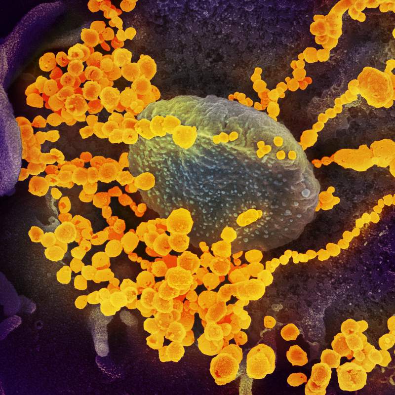 Novel Coronavirus SARS-CoV-2–This scanning electron microscope image shows SARS-CoV-2 (round gold objects) emerging…