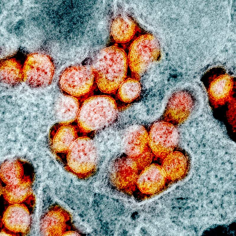 Novel Coronavirus SARS-CoV-2–Transmission electron micrograph of SARS-CoV-2 virus particles, isolated from a patient.…