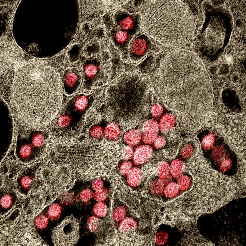 Novel Coronavirus SARS-CoV-2–Transmission electron micrograph of SARS-CoV-2 virus particles, isolated from a patient.…