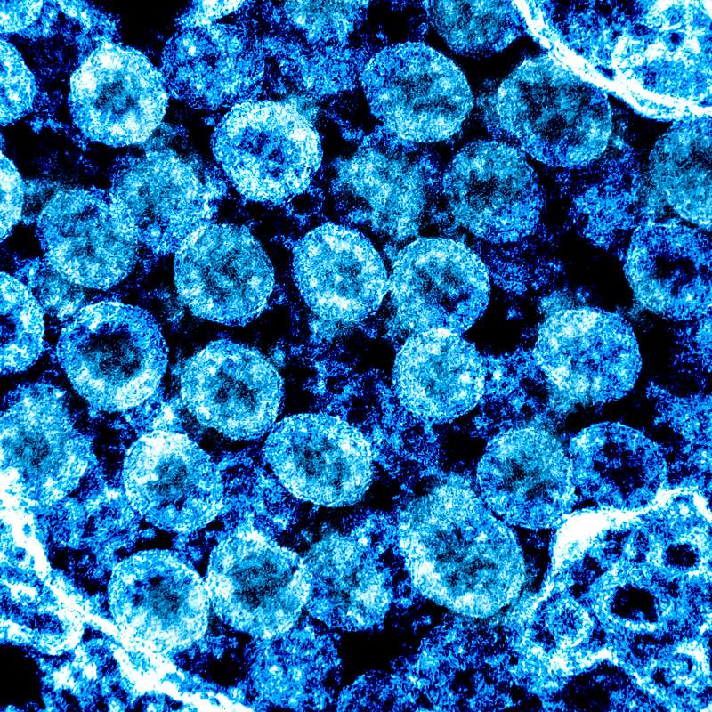 Novel Coronavirus SARS-CoV-2–Transmission electron micrograph of SARS-CoV-2 virus particles, isolated from a patient.…