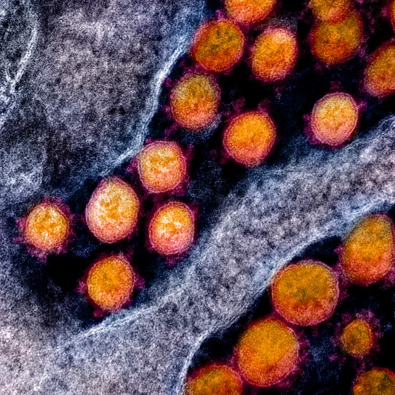 Novel Coronavirus SARS-CoV-2–Transmission electron micrograph of SARS-CoV-2 virus particles, isolated from a patient.…