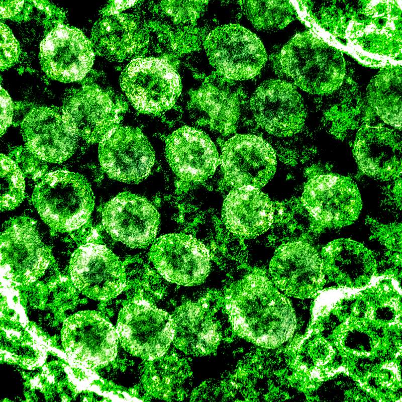 Novel Coronavirus SARS-CoV-2–Transmission electron micrograph of SARS-CoV-2 virus particles, isolated from a patient.…
