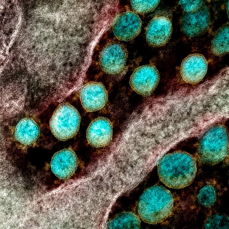 Novel Coronavirus SARS-CoV-2–Transmission electron micrograph of SARS-CoV-2 virus particles, isolated from a patient.…