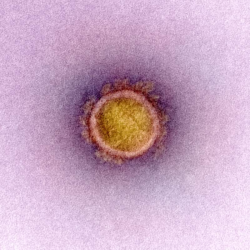 Novel Coronavirus SARS-CoV-2–Transmission electron micrograph of SARS-CoV-2 virus particles, isolated from a patient.…