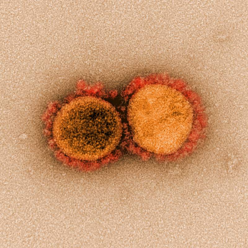 Novel Coronavirus SARS-CoV-2–Transmission electron micrograph of SARS-CoV-2 virus particles, isolated from a patient.…