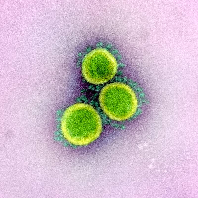 Novel Coronavirus SARS-CoV-2–Transmission electron micrograph of SARS-CoV-2 virus particles, isolated from a patient.…