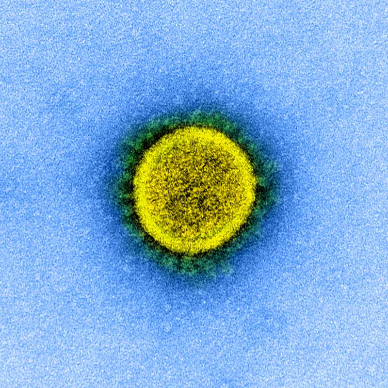 Novel Coronavirus SARS-CoV-2–Transmission electron micrograph of SARS-CoV-2 virus particles, isolated from a patient.…