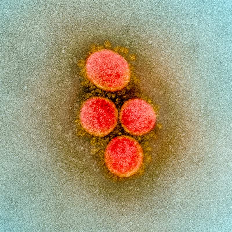 Novel Coronavirus SARS-CoV-2–Transmission electron micrograph of SARS-CoV-2 virus particles, isolated from a patient.…