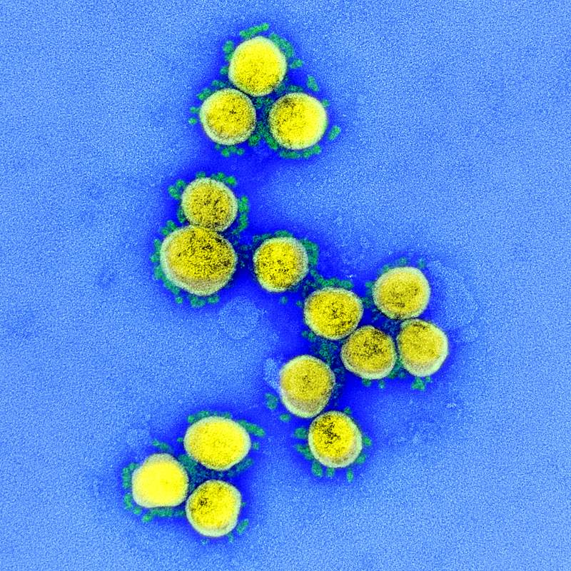 Novel Coronavirus SARS-CoV-2–Transmission electron micrograph of SARS-CoV-2 virus particles, isolated from a patient.…