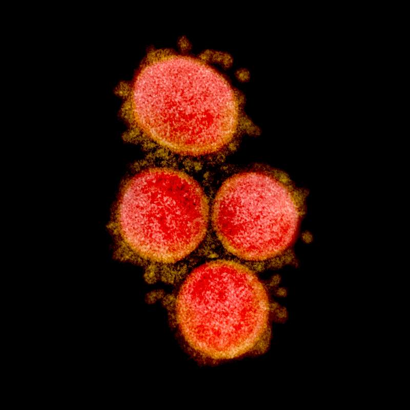 Novel Coronavirus SARS-CoV-2–Transmission electron micrograph of SARS-CoV-2 virus particles, isolated from a patient.…