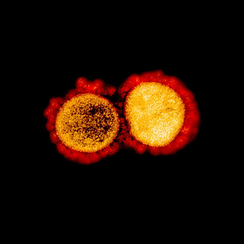 Novel Coronavirus SARS-CoV-2–Transmission electron micrograph of SARS-CoV-2 virus particles, isolated from a patient.…
