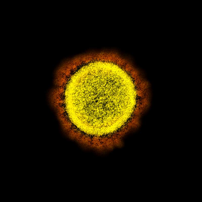 Novel Coronavirus SARS-CoV-2–Transmission electron micrograph of SARS-CoV-2 virus particles, isolated from a patient.…