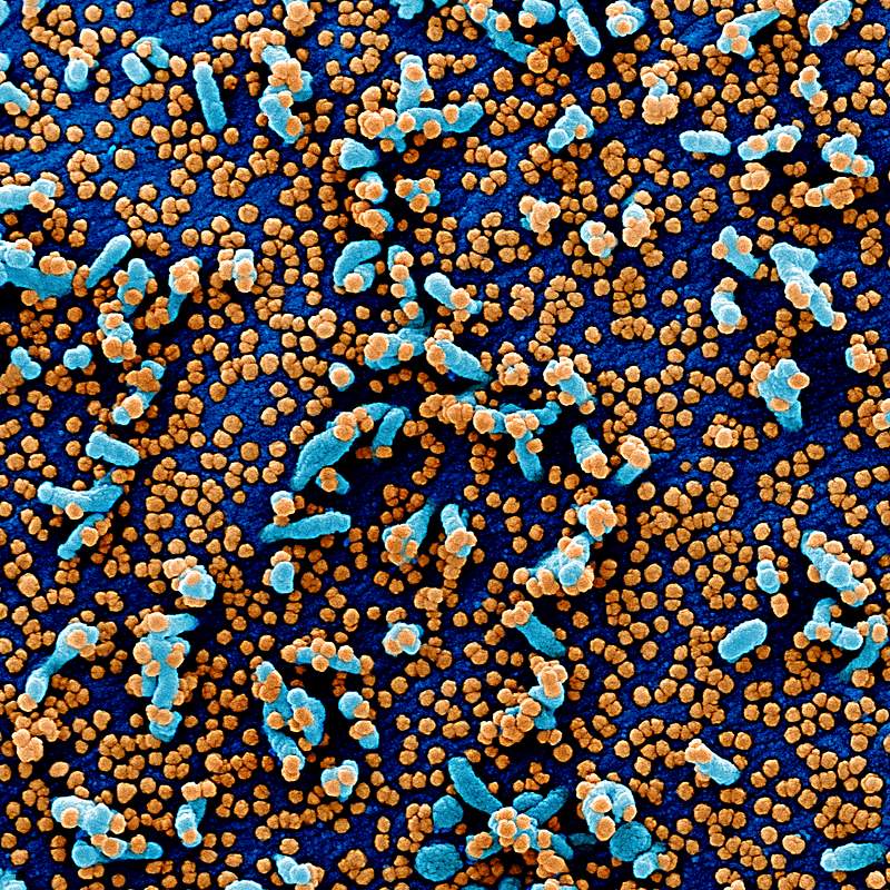 Novel Coronavirus SARS-CoV-2–Colorized scanning electron micrograph of a VERO E6 cell (blue) heavily infected with SARS…