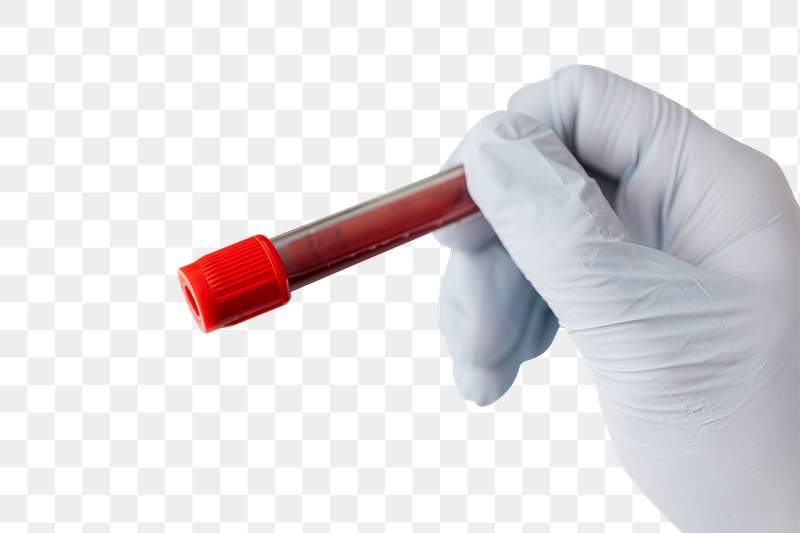 Scientist Hand Holding A Blood Test Tube On A Green Background Free Illustration 2316041